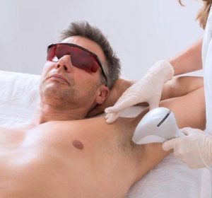 Laser-Hair-Removal-